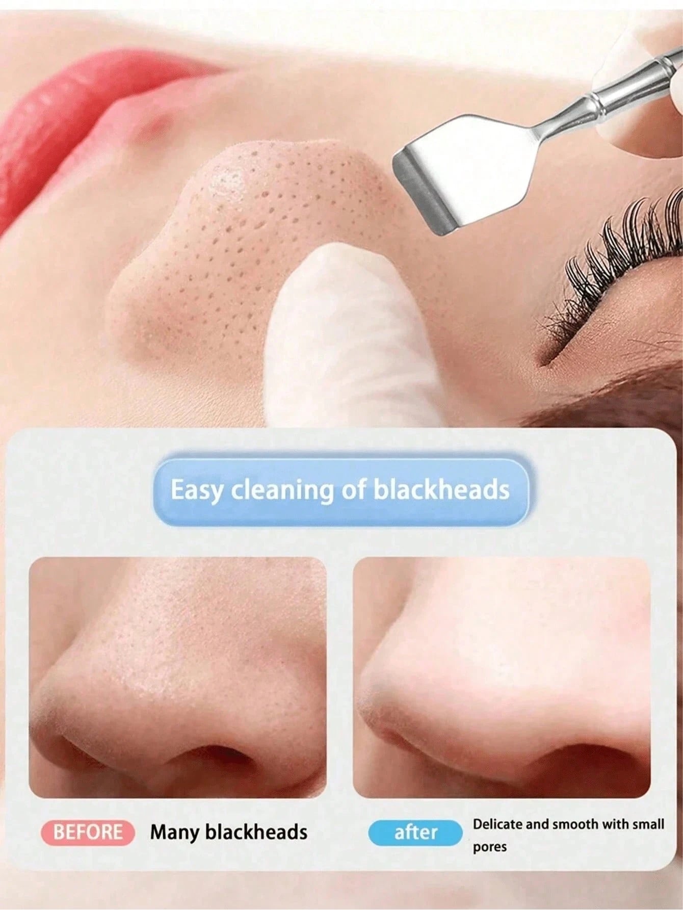 Stainless Steel Blackhead Remover, Blackhead Cleaning Pimple Removal Tool, Acne Comedone Extractor, Manual Pore Cleansing Beauty Care,Blackhead Remover,Beauty,Skin Care Products,Spa,Self Care,Skin Car