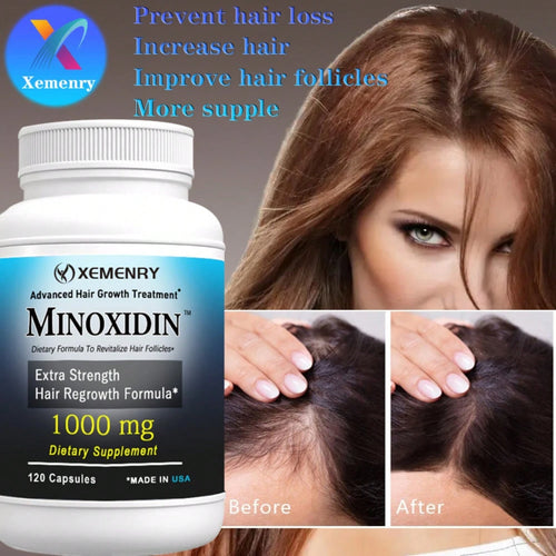XEMENRY Minnoxidin- Extra Strength Hair Regrowth Formula,Prevent Hair Loss, Repair Hair, Help Promote Hair Follicle Activity- 120pcs